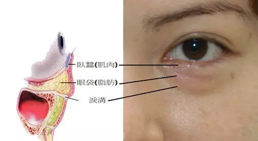 眼袋的位置