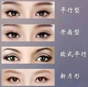 常见的几种双眼皮类型