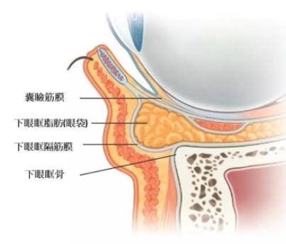 为什么会出现眼袋