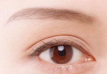 割双眼皮的恢复期要多长时间呢？