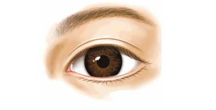双眼皮术后上眼睑外翻是否能恢复根据情况来定
