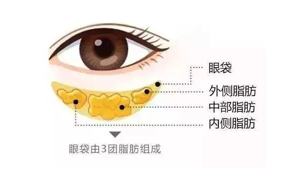 韩国清潭FIRST整形外科去眼袋手术做得好