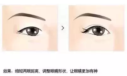 清潭first开眼角的效果