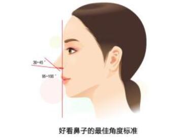 清潭first李丙玟告诉你哪些情况算鼻手术失败需要修复呢？