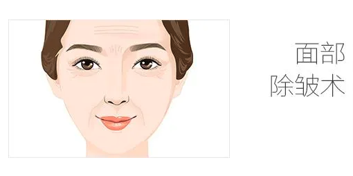 面部除皱术要花多少钱？来看看韩国清潭FIRST拉皮手术费用