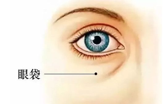 外切眼袋回填泪沟后是硬的可能和这些因素有关,附改善方法