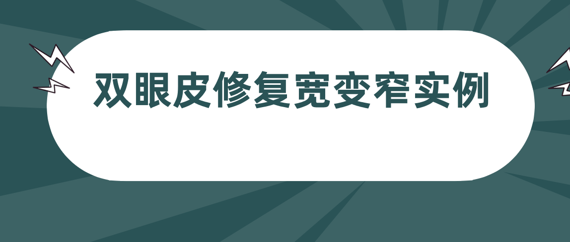 双眼皮修复宽变窄实例