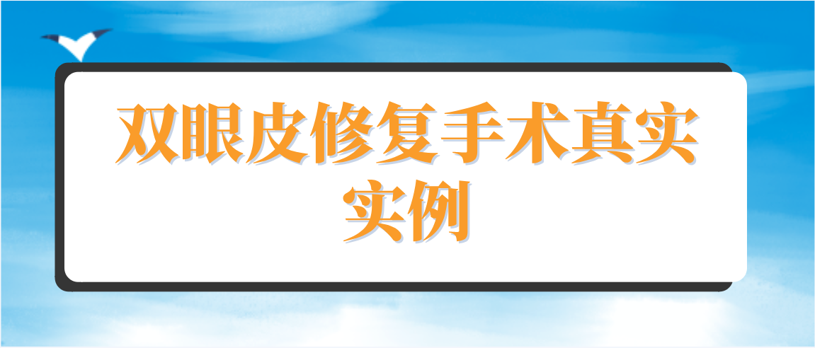 双眼皮修复手术的真实实例