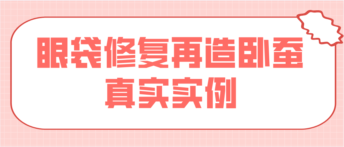 眼袋修复再造卧蚕真实实例分享